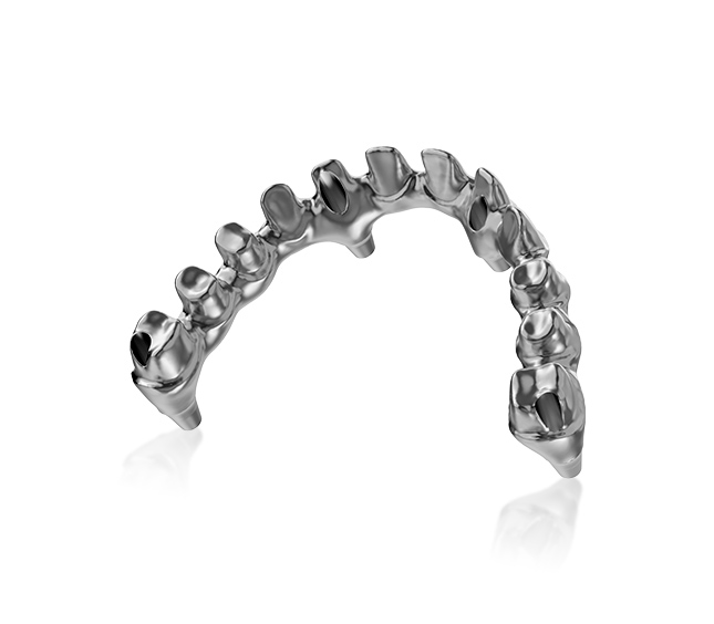 Implant bridge
