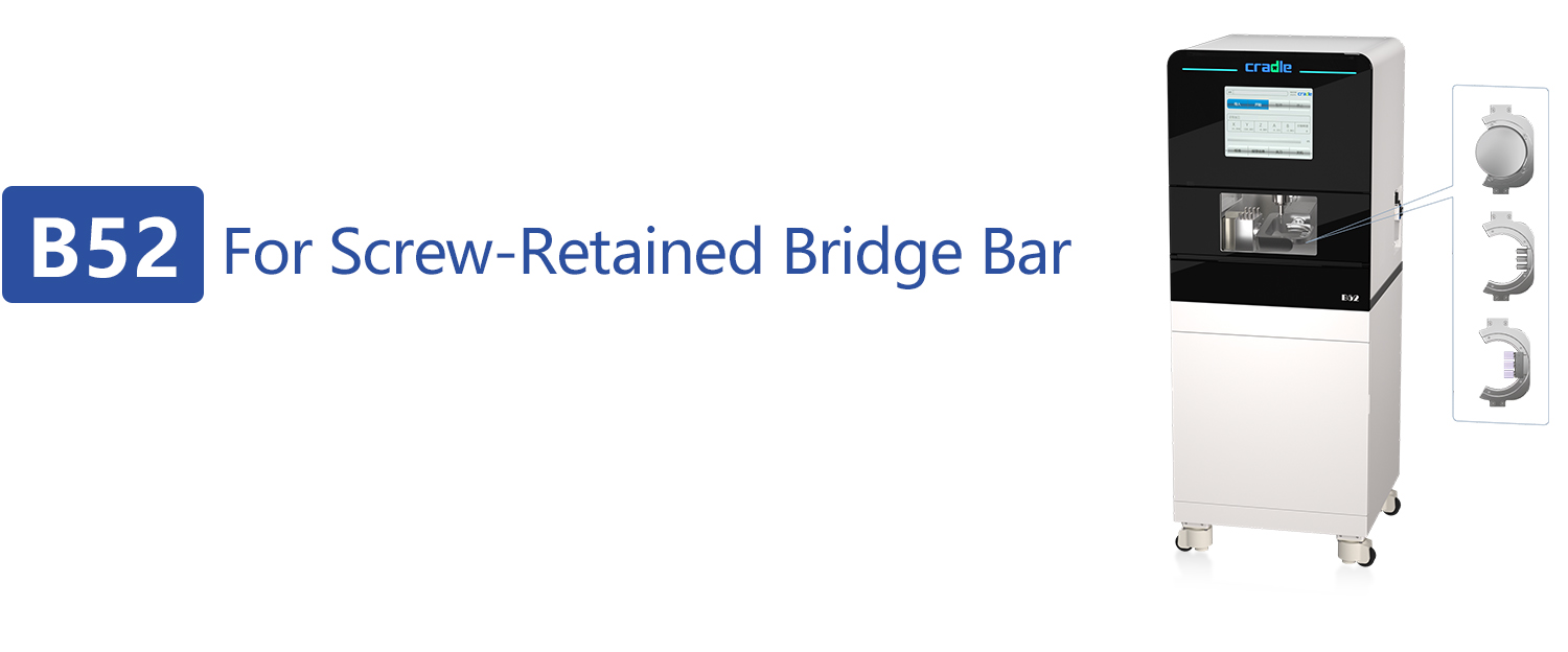 B52 For Screw-Retained Bridge Bar